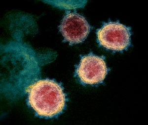 Image au microscope électronique d'un coronavirus mais le ou la COVID-19 ?